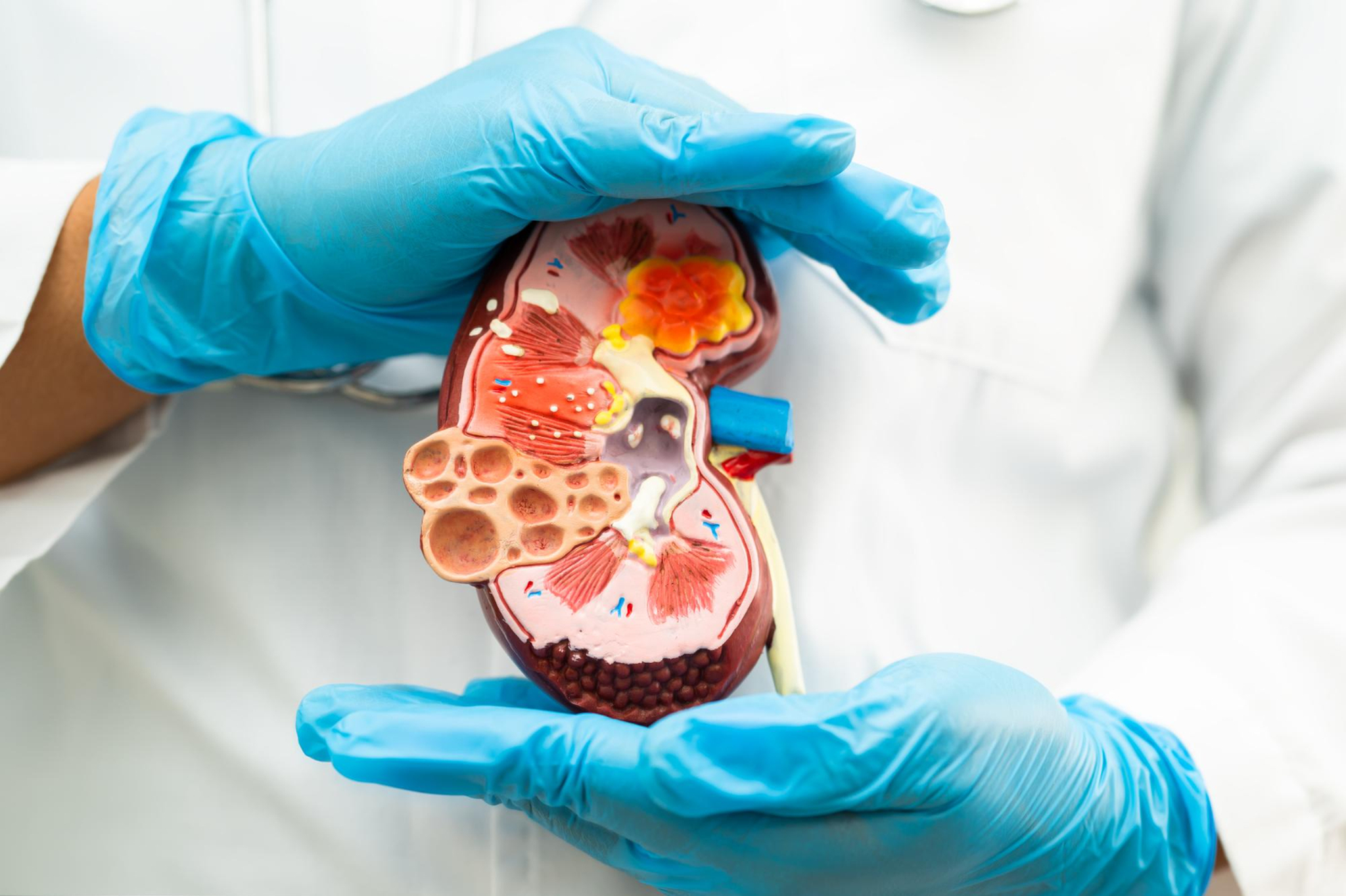 Adrenal gland tumors: a modern approach to diagnosis and treatment
